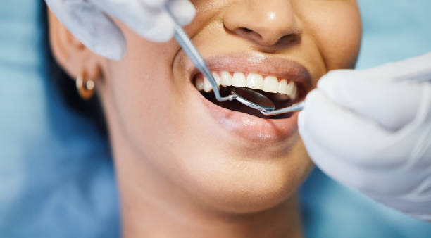 Best Emergency Dental Extractions in Poughkeepsie, NY